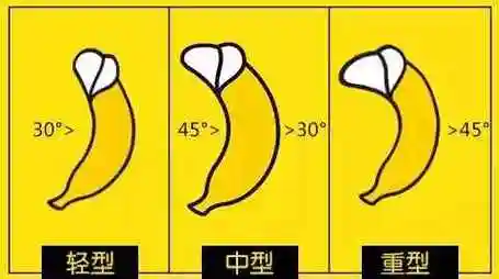 弯曲的丁丁可以掰直吗?