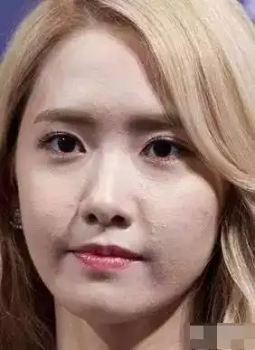 黑头毛孔闭口不解决,怎么能成为可爱小仙女!