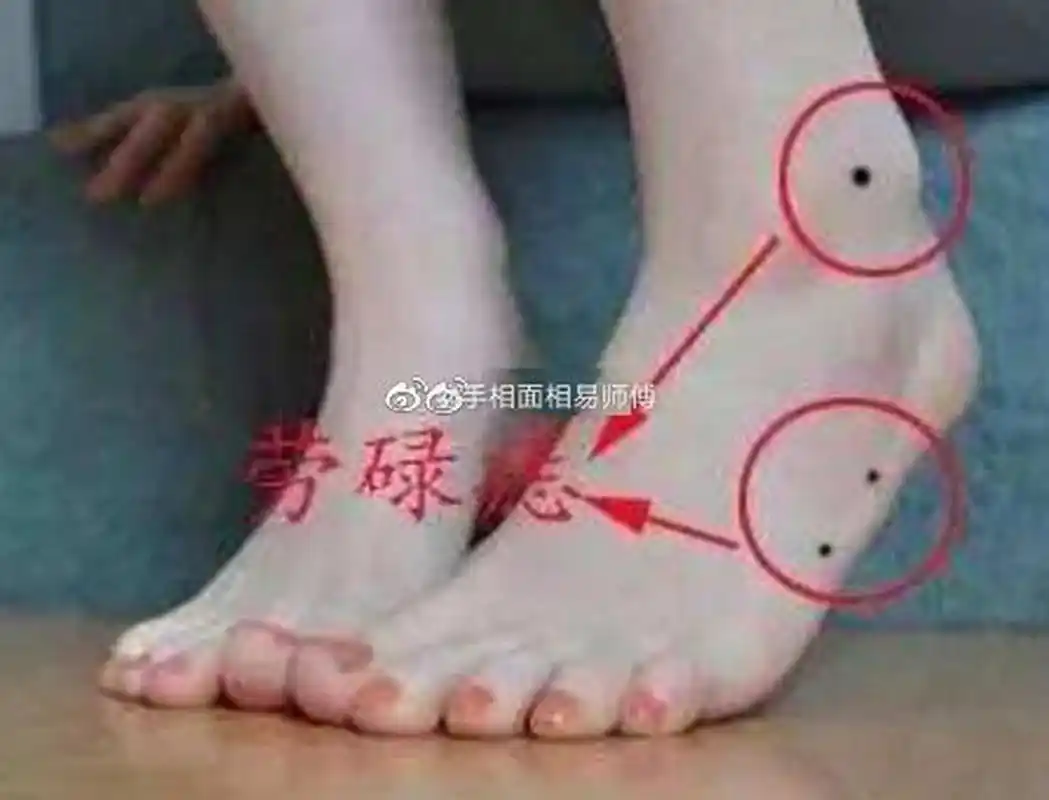 女右脚腕上方有痣好吗(女人右脚踝上方有痣代表什么)