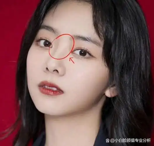 整形医生:幼态脸天花板谭松韵,为何不够精致的鼻子反而加分