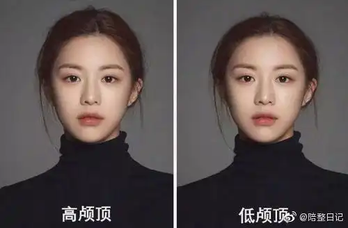 低颅顶到底是颜值bug还是审美过度高颅顶才美未免太过绝对