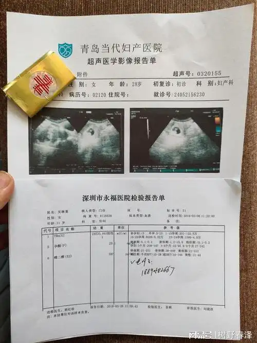 女性在怀孕早期会出现褐色分泌物是什么情况确定妊娠后不准备生育|血