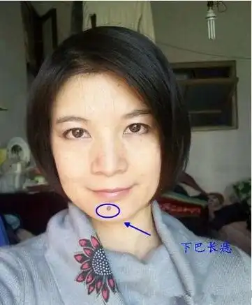 下巴有痣会怎样你的下巴痣长在什么地方