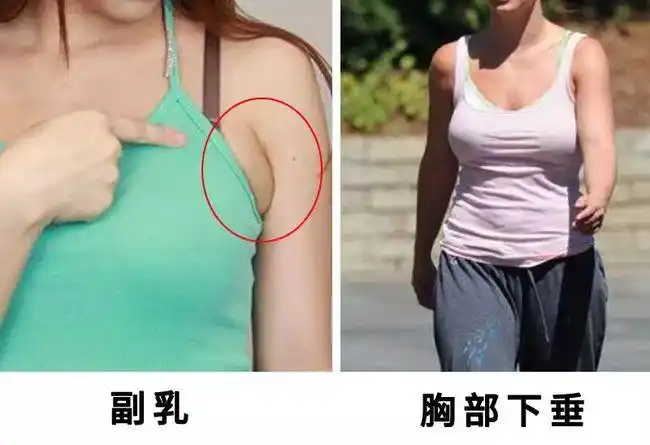 女生糟蹋乳房的三个行为熬夜是其次有一个很多人忽略了