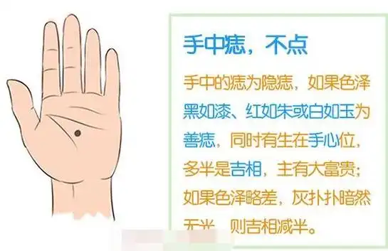 女人手掌心有痣,表示生活烦恼很少,衣食无忧,生活富足.