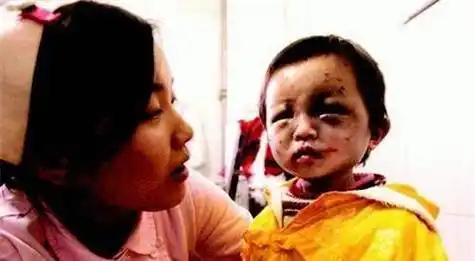 青海小苏丽:3岁被针线缝嘴,5岁被虐死,母亲出狱后将其挫骨扬灰