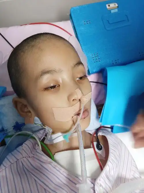 漂亮女儿患重症父亲哭诉我想让你活下来不知道这样对不对