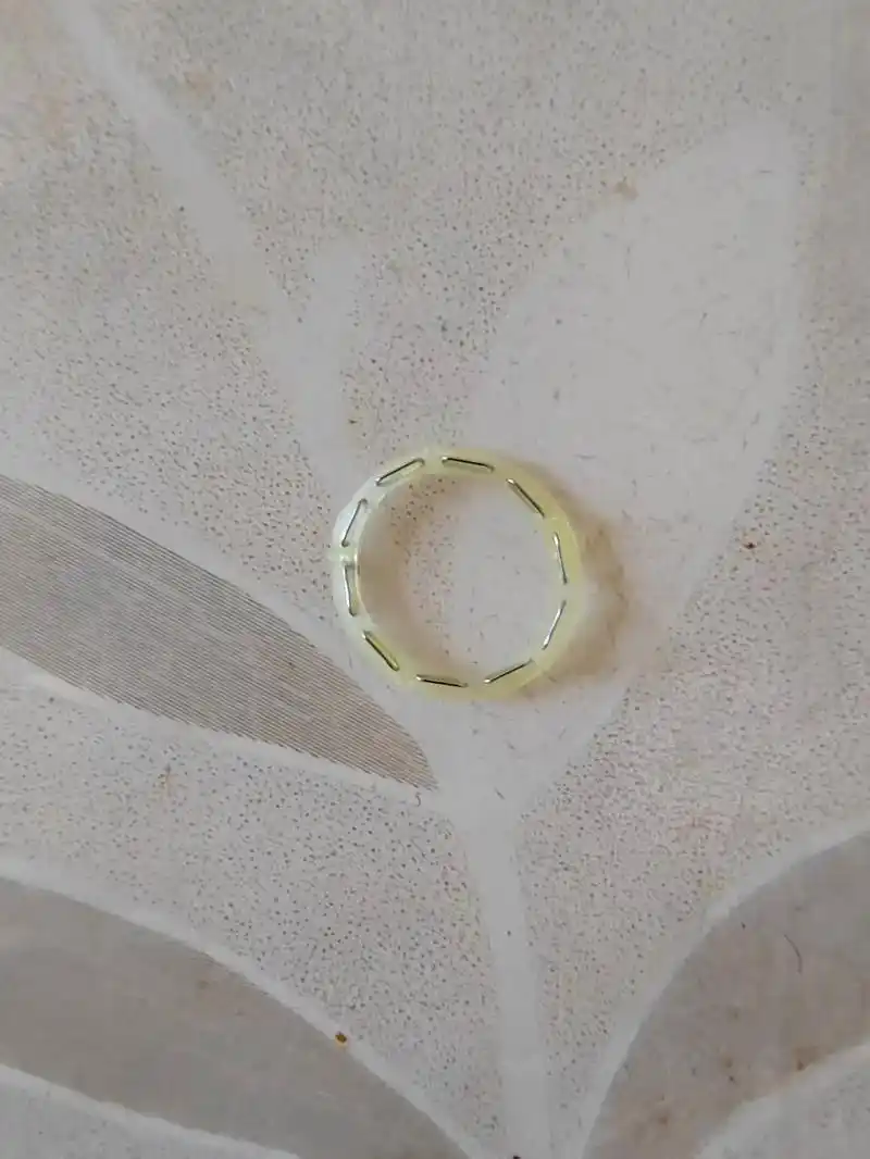 这1400百块的钛钉环终于脱落了!老母亲悬着的一颗 - 抖音