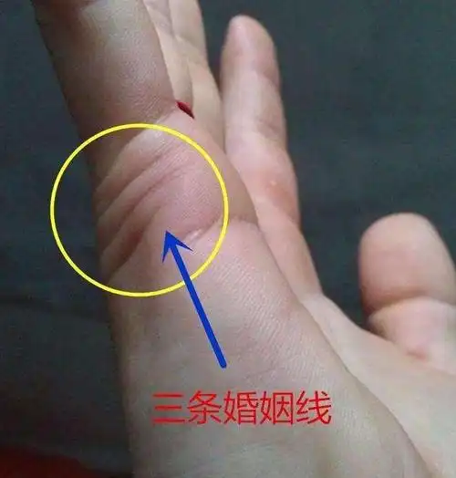 生命之线阅读答案_手相生命线的姐妹线_男人生命线