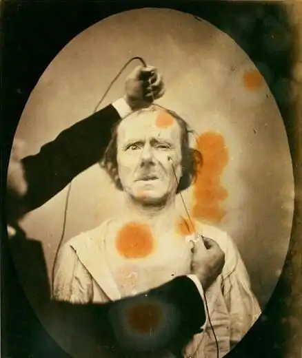 达尔文最后的恐怖实验 用电流刺激面部肌肉做表情堪比酷刑