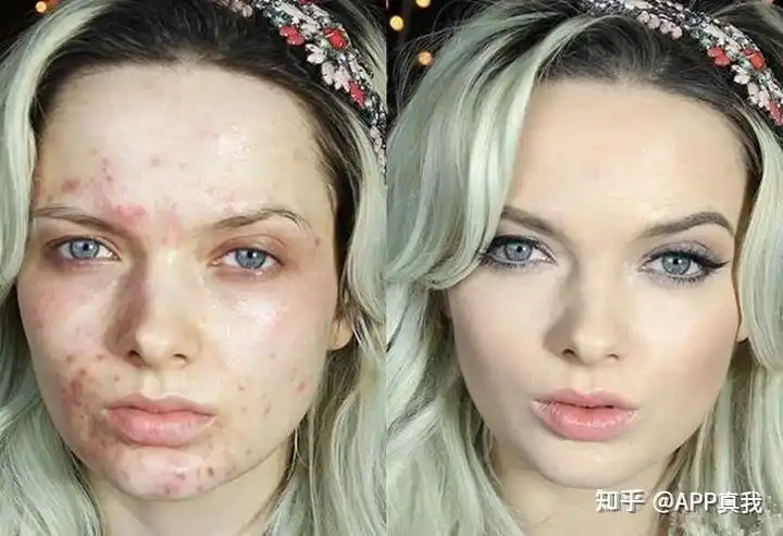 皮肤的好坏对颜值的改变有多大? - 知乎