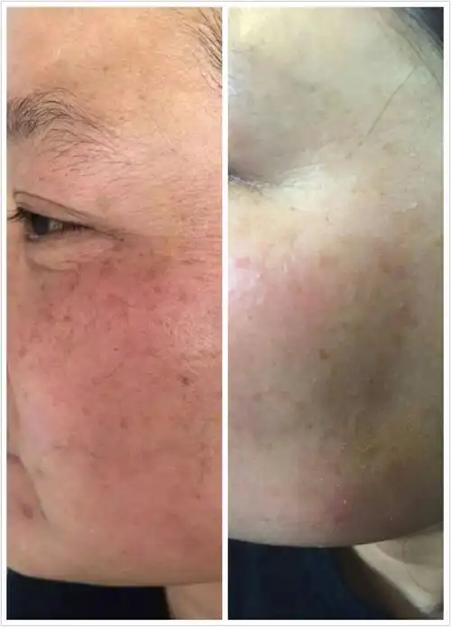 真人效果对比图