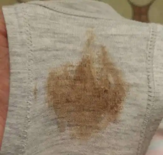 孕期内裤总是黄黄的这是胎儿发的求救信号内裤隐患要知道