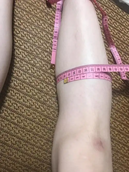 前几天有酸的感觉,但是今天量腿围对比29号当天拍的_圈子-新氧美容