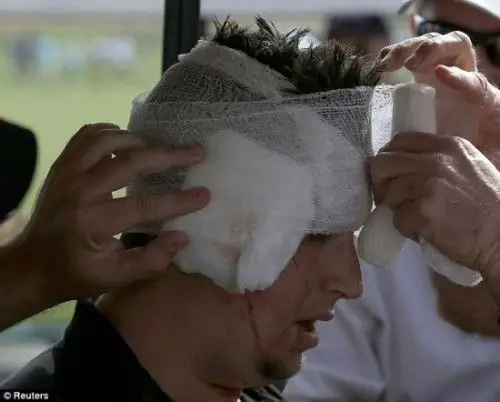 头被包扎的图片