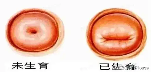 骗谁不要骗医生!有没有生育过?妇科 - 抖音