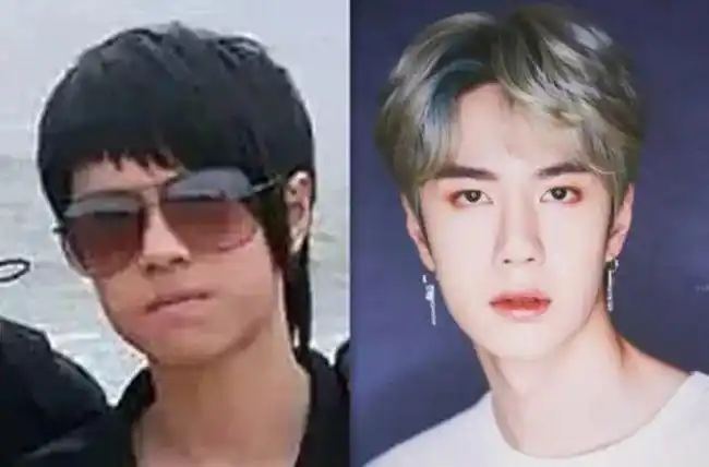 王一博疑似整容痕迹明显