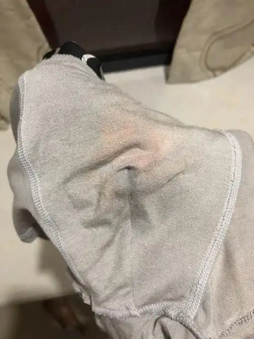 发现内裤的颜色这样,应该不是尿液染的吧?