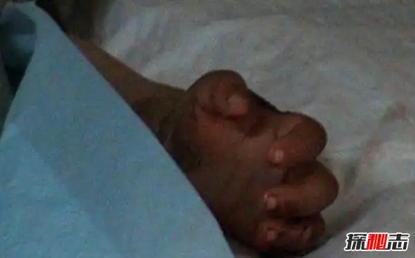 小苏丽事件是真的吗小苏丽验尸照片死后遭亲生母亲扒坟