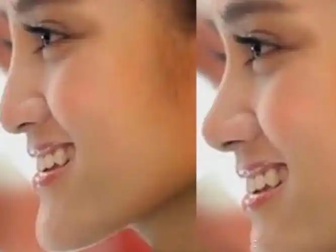 05被公认的超丑侧脸一回头毁掉整张脸看看是不是你60