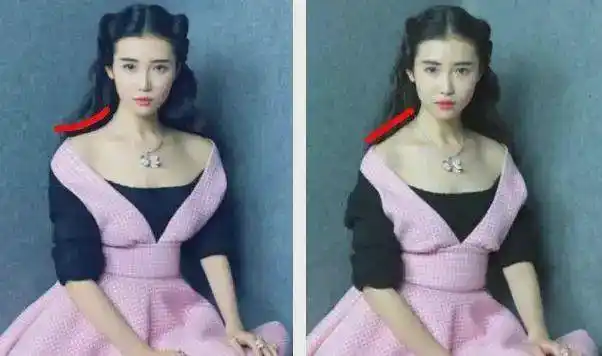 那么 如何消除斜方肌肥大呢?