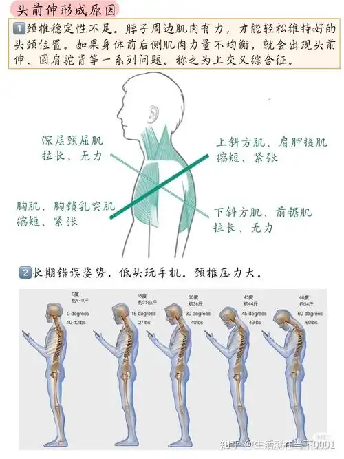 脖子前倾,有什么简便易行的改善方法吗?