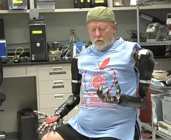 3.电子智能义肢(smart powered prostheses)