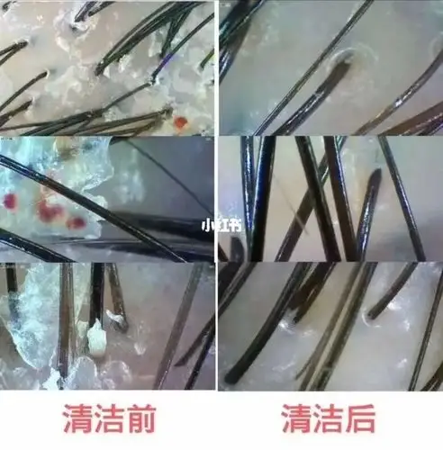 快让头皮做个清洁吧!舒缓头深沉清洁温和去角质.