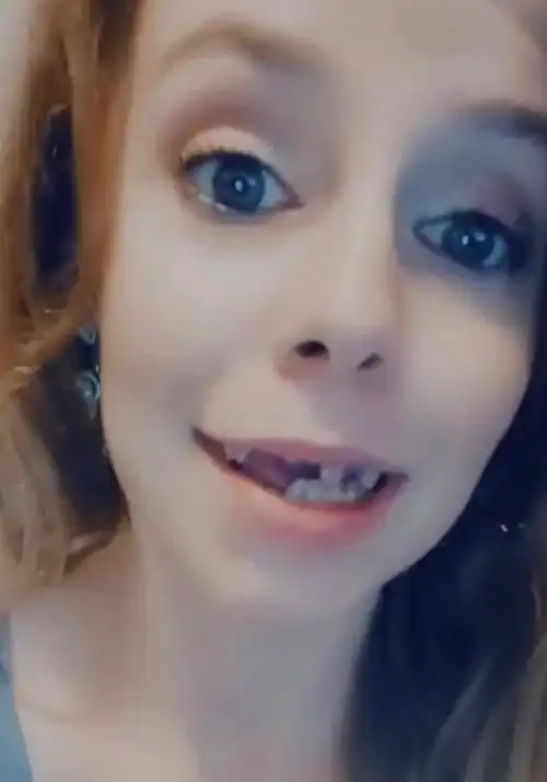 24岁女子牙齿全腐烂脱落 完美微笑彻底被毁