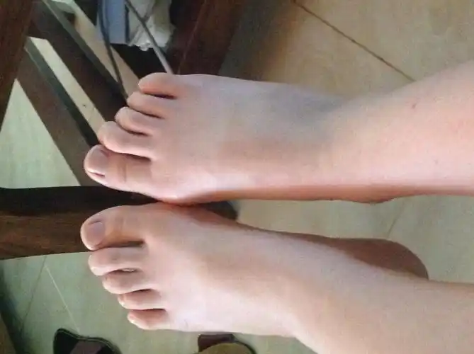 13岁的女生,脚已经有37码了.而且脚又宽又丑,怎么办啊.