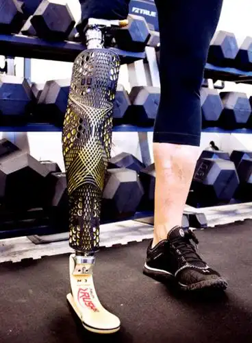很多人现在穿的是机械假肢,如在过去的10年推动的多功能假肢部既珑