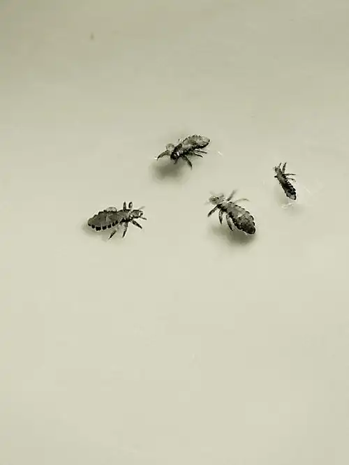 阴虱只"喜欢"女性?阴虱的3种传播途径,如果感染时,做好3点!