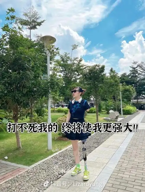 穿上假肢,重开人生.