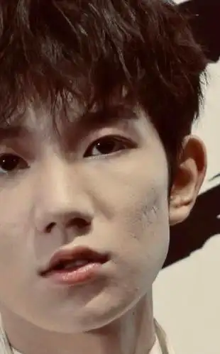 王源脸上重度痤疮,从此以后还能重回颜值巅峰吗?