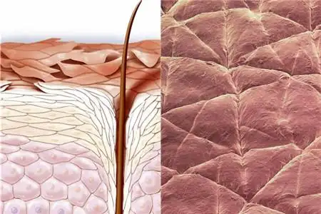 图角质层厚的表现肌肤粗糙无光泽