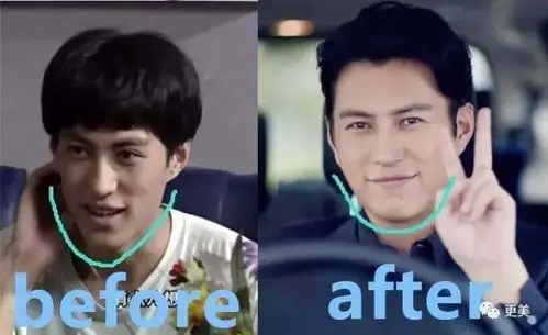 脸上的肉肉也多了不少,倒是增加了观众缘.早期的靳东实在是太!瘦!了!