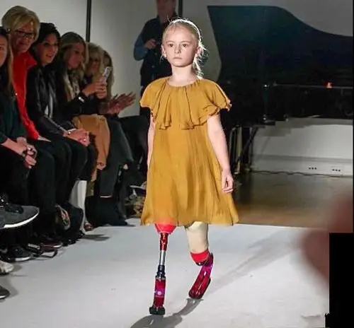 双腿截肢的7岁英国小姑娘装上义肢t台走秀,气场不输名模!