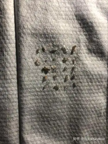 60 人赞同了该回答 十五天全部掉完,基本全是手动脱落,没有什么钉子是