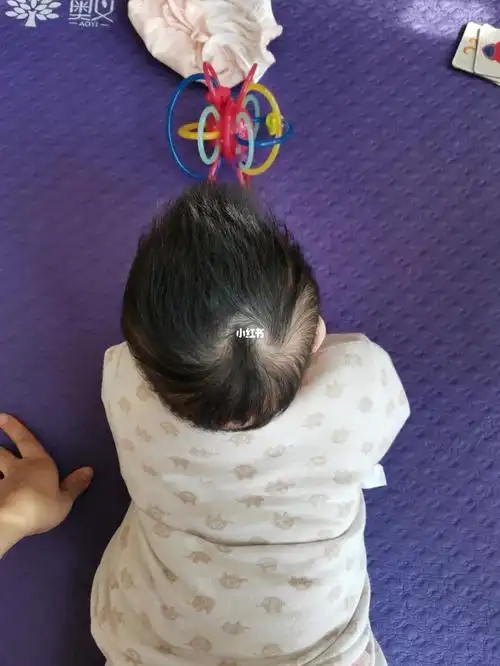 3个月的宝宝头型这样,还可以吗