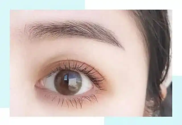 常见双眼皮大盘点,第1种更好看!