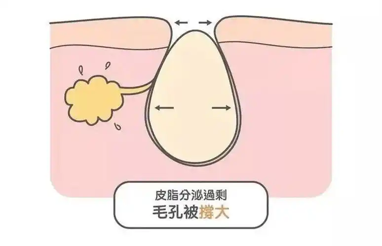 护肤常识毛孔大作战有哪些收缩毛孔的好方法
