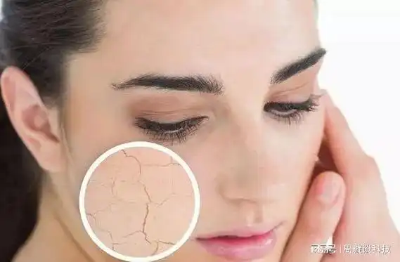 皮肤缺水, 干燥,紧绷与不适, 了解皮肤状况与应对措施