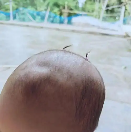 带出门总被人当成弟弟,因为小女孩的头发又短又稀疏十足一个男孩子像