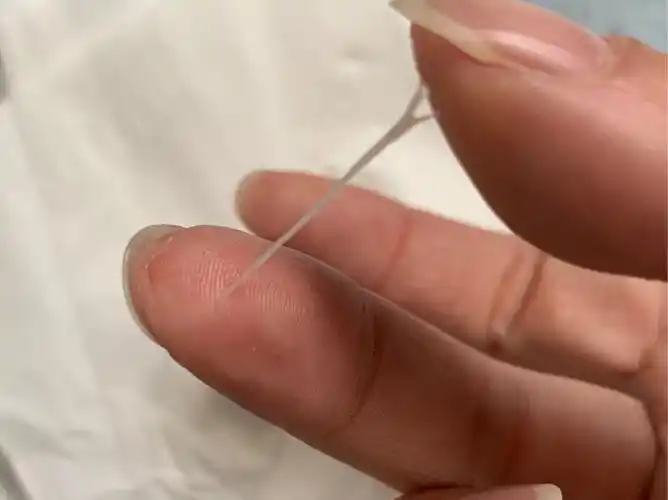 排卵后第8天的白带,好像又拉丝了