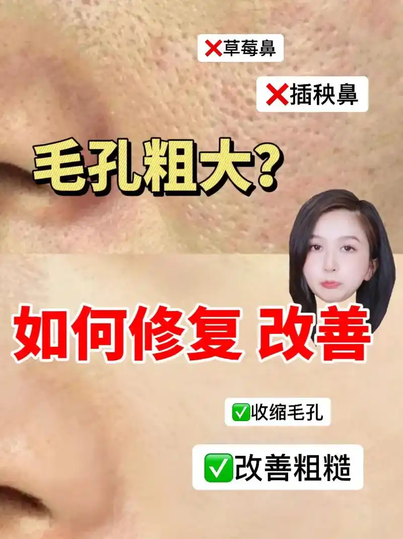 修复毛孔这件事,我是真的悟了#护肤 #科学护肤 #毛孔粗大  - 抖音