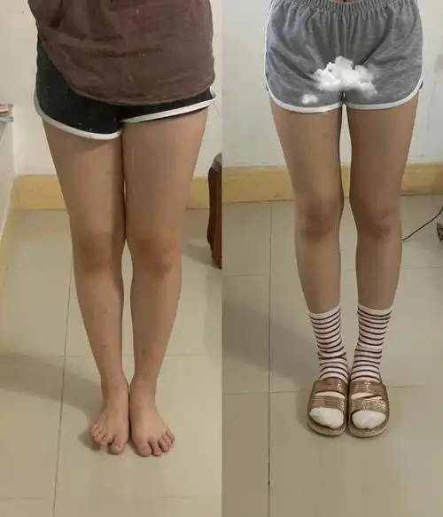 我不管我也有大腿缝隙了01