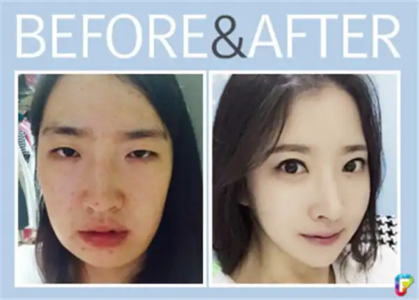 虽然我们看到过许多韩国人整容前后的震撼对比图,但是这15张图片又让
