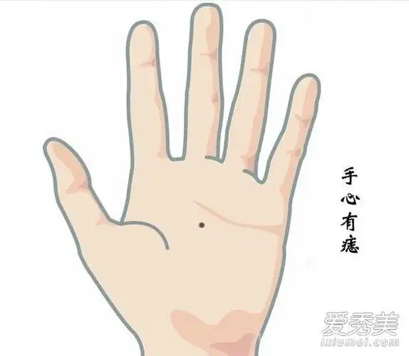 左手无名指的痣,这代表着前世姻缘.痣越接近指根就代表情缘越深.