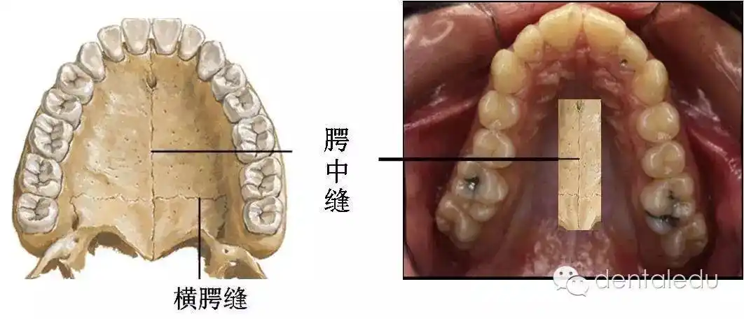 在胚胎第8周末开始,面部两侧上颌突的内侧面向中央生出侧腭突,其前半