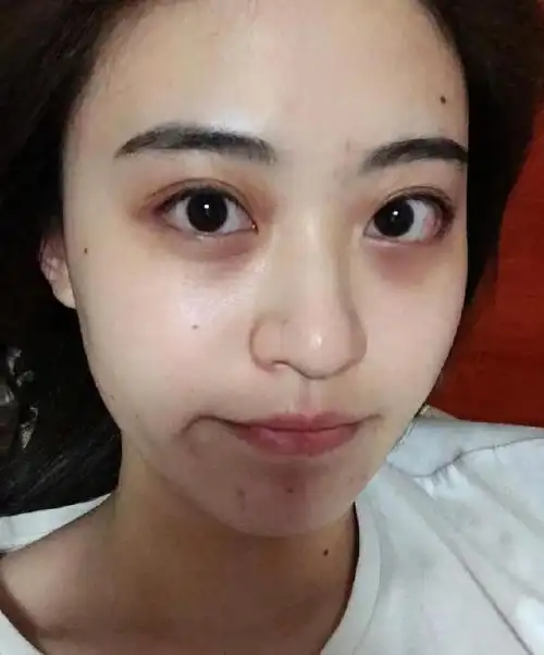 这几个拉低颜值的行为,女生尽量避开,难怪皮肤差还不好看!